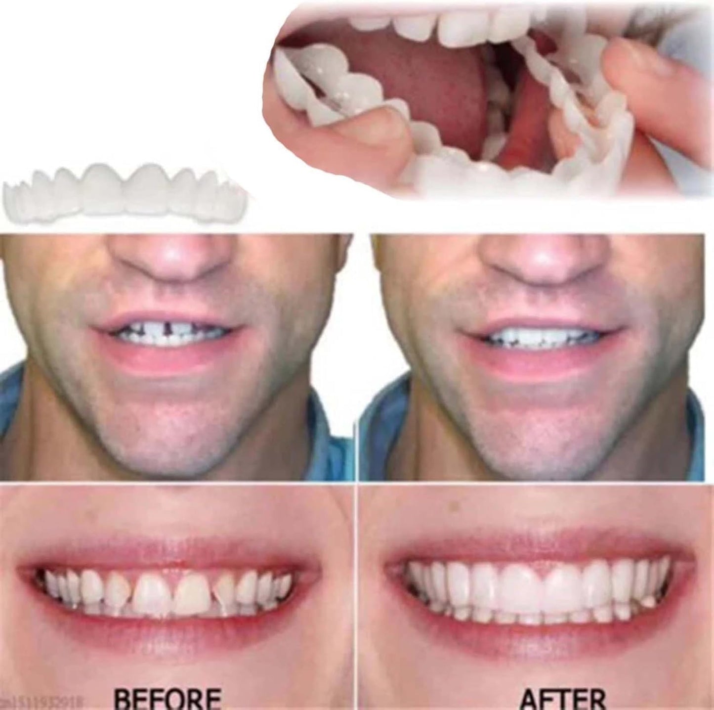 2 Pairs Temporarily Adjustable Smile Aligners – Natural & Comfortable for Men & Women (White)