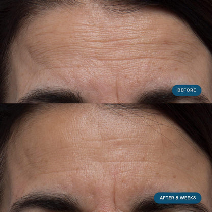 ELEMIS Pro-Collagen Skin Future Supplements — Daily Ingestible for Hydration, Elasticity & Fine Lines | 60 Capsules
