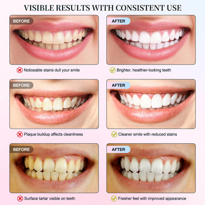Niacinamide Whitening Toothpaste 3.5oz – Stain Removal & Enamel Protection