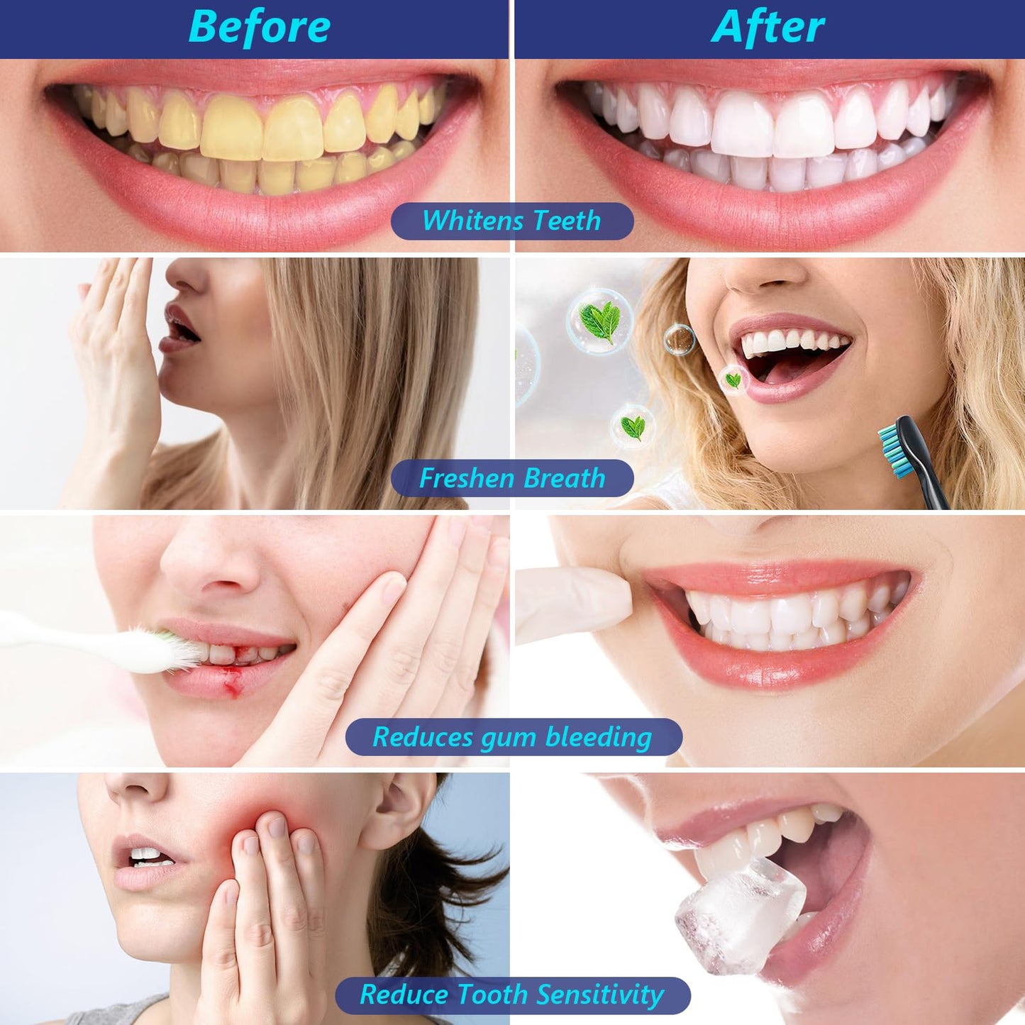 7.5% Nano Hydroxyapatite Toothpaste – Fluoride-Free Whitening & Sensitivity Relief (6 Pack)