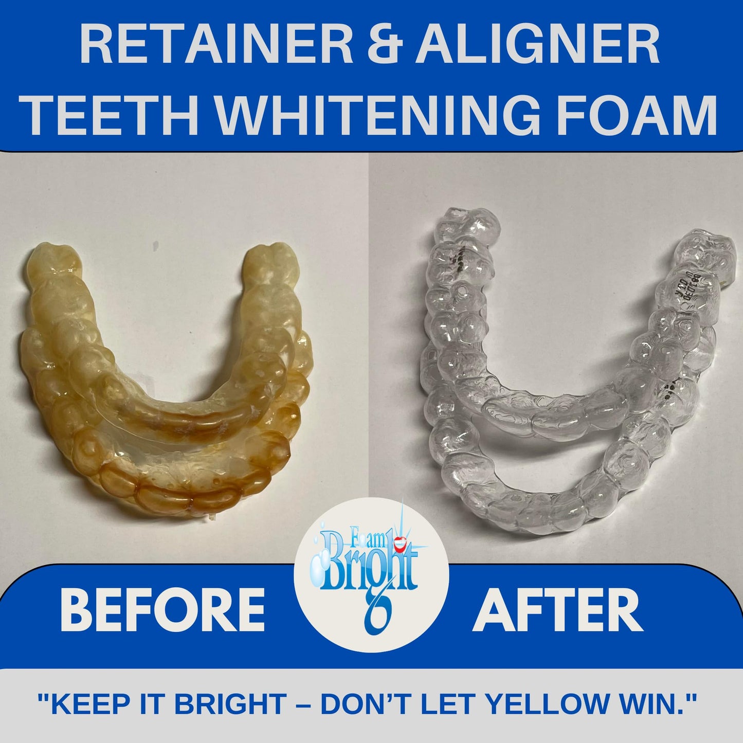 FoamBright Retainer & Aligner Cleaner Foam – Peroxide-Free Oral Care for Invisalign, Braces, and Teeth Whitening