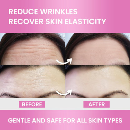 Forehead Wrinkle Patches Overnight Smoothing – Anti Wrinkle Patches for Face & Forehead | 12 pcs