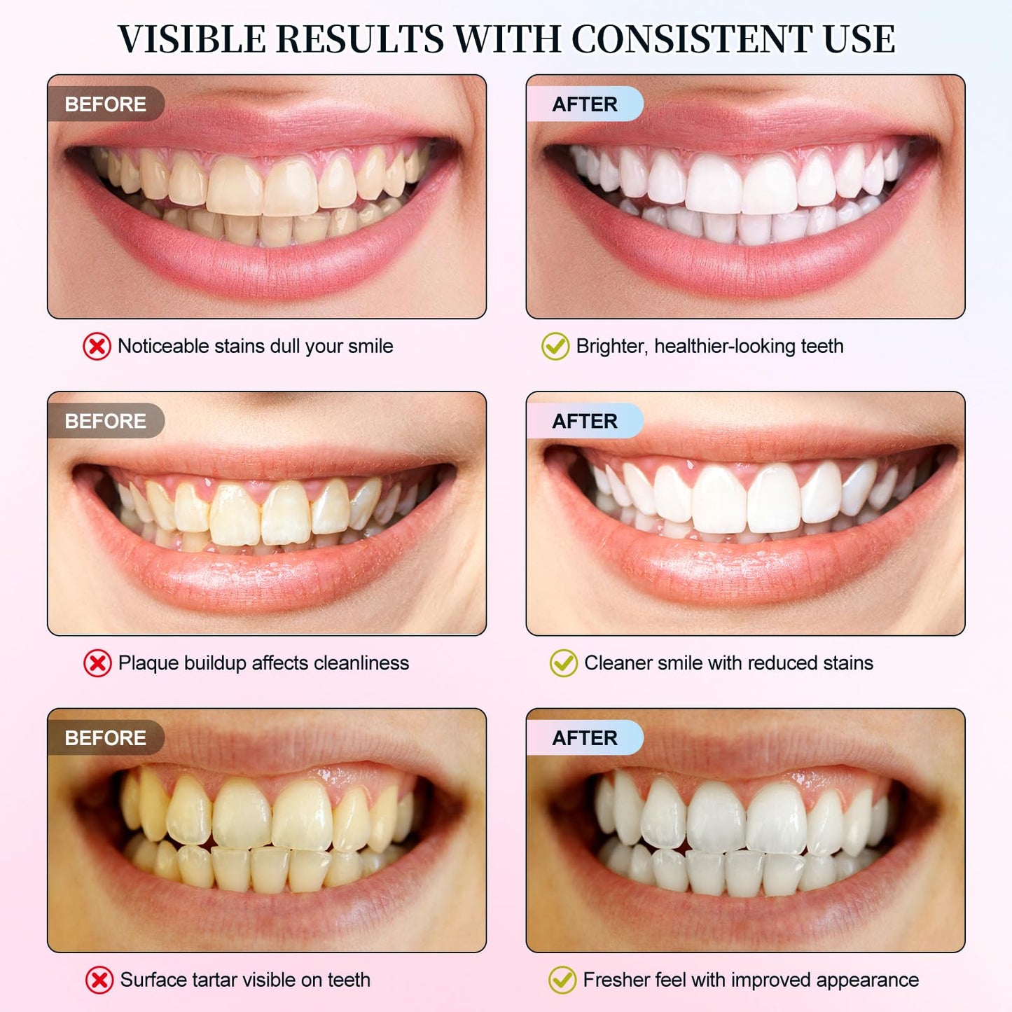 Niacinamide Whitening Toothpaste 2 Pack – Fluoride-Free, Enamel Repair & Fresh Breath