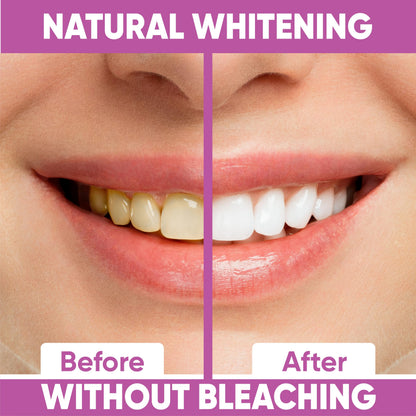 Gentle Teeth Whitening Strips - 28 Stripes | Peroxide-Free Whitening