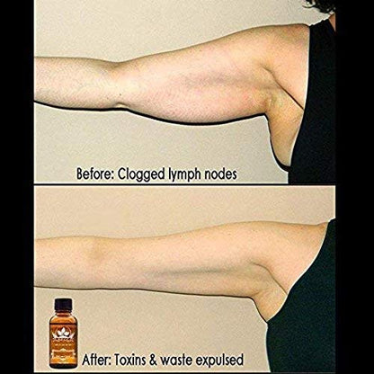 3 Pack Ginger Lymphatic Drainage Massage Oil – Boost Circulation & Metabolism (90ml)