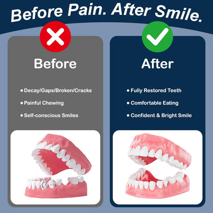 Dental Lab Denture Repair Glue (1oz) – Fast-Setting Bonding Adhesive for Dentures