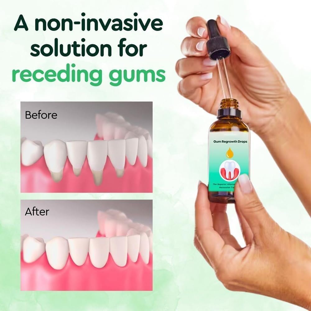 Gum Relief Drops – DentiZen Natural Gum Liquid Drops for Teeth & Gums | 2 Pcs
