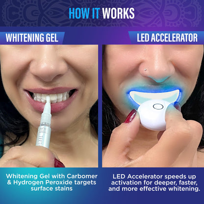 GuruNanda Teeth Whitening Kit with LED Light – Wireless, 40 Treatments