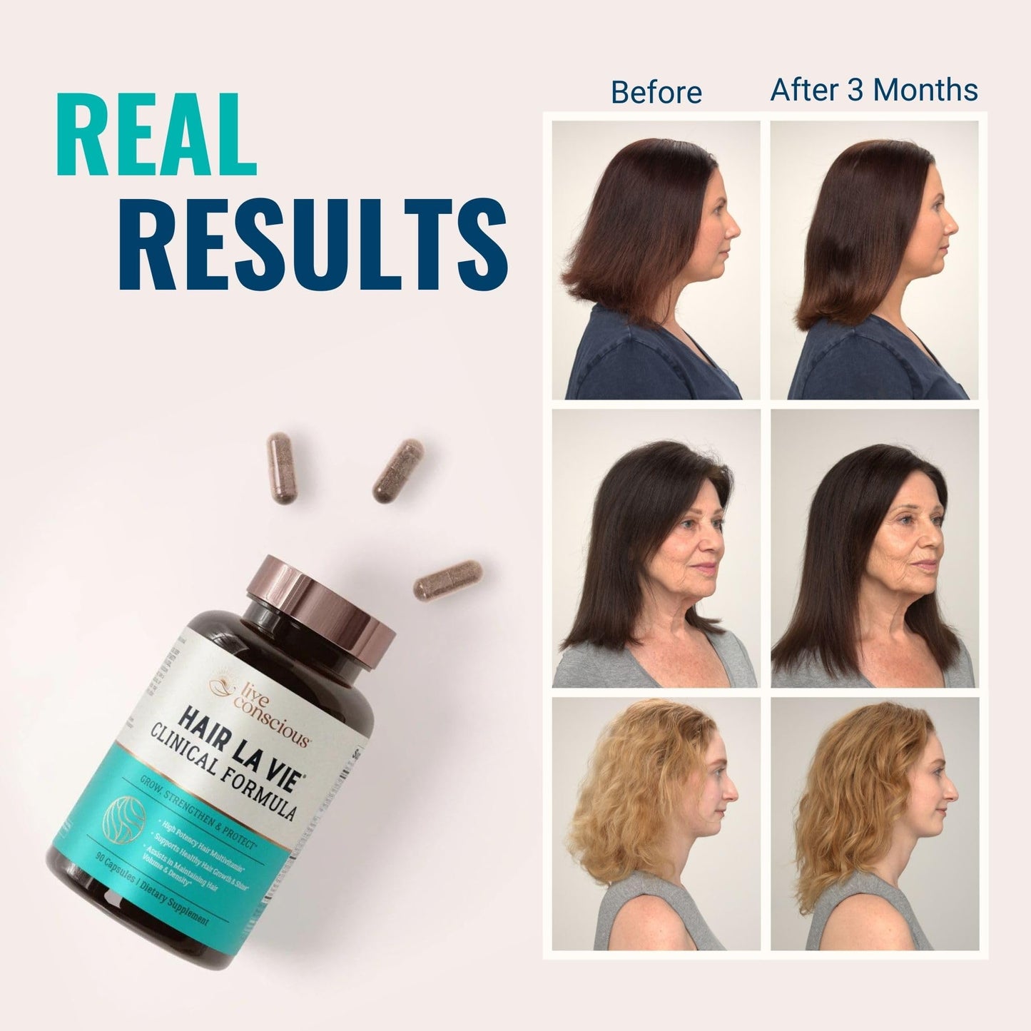 Hair La Vie Live Conscious Clinical Formula Hair Vitamins – Biotin & Saw Palmetto (2-Pack)