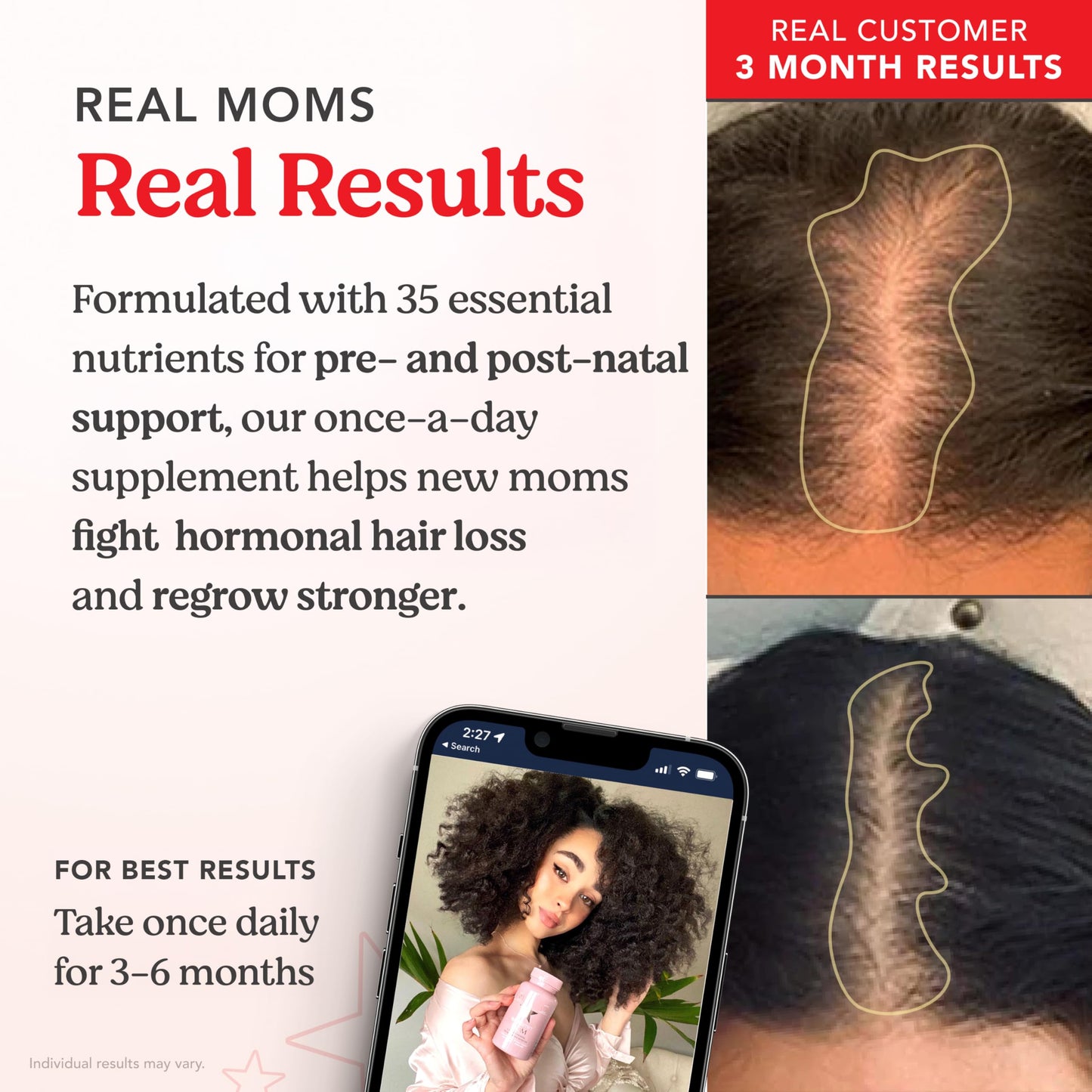 HAIRtamin MOM Vegan Prenatal & Postnatal Multivitamin – Hair, Nails & Skin Support | 3-Pack