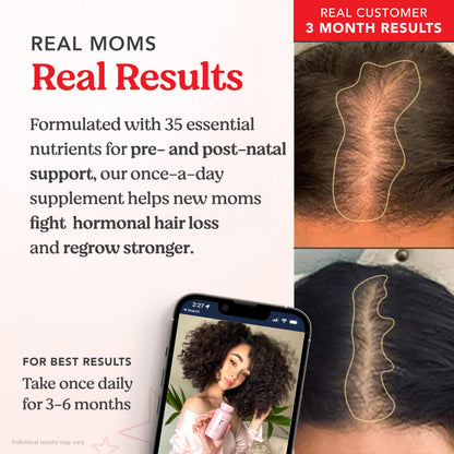 HAIRtamin MOM Vegan Prenatal & Postnatal Multivitamin – Hair, Nails & Skin Support | 3-Pack