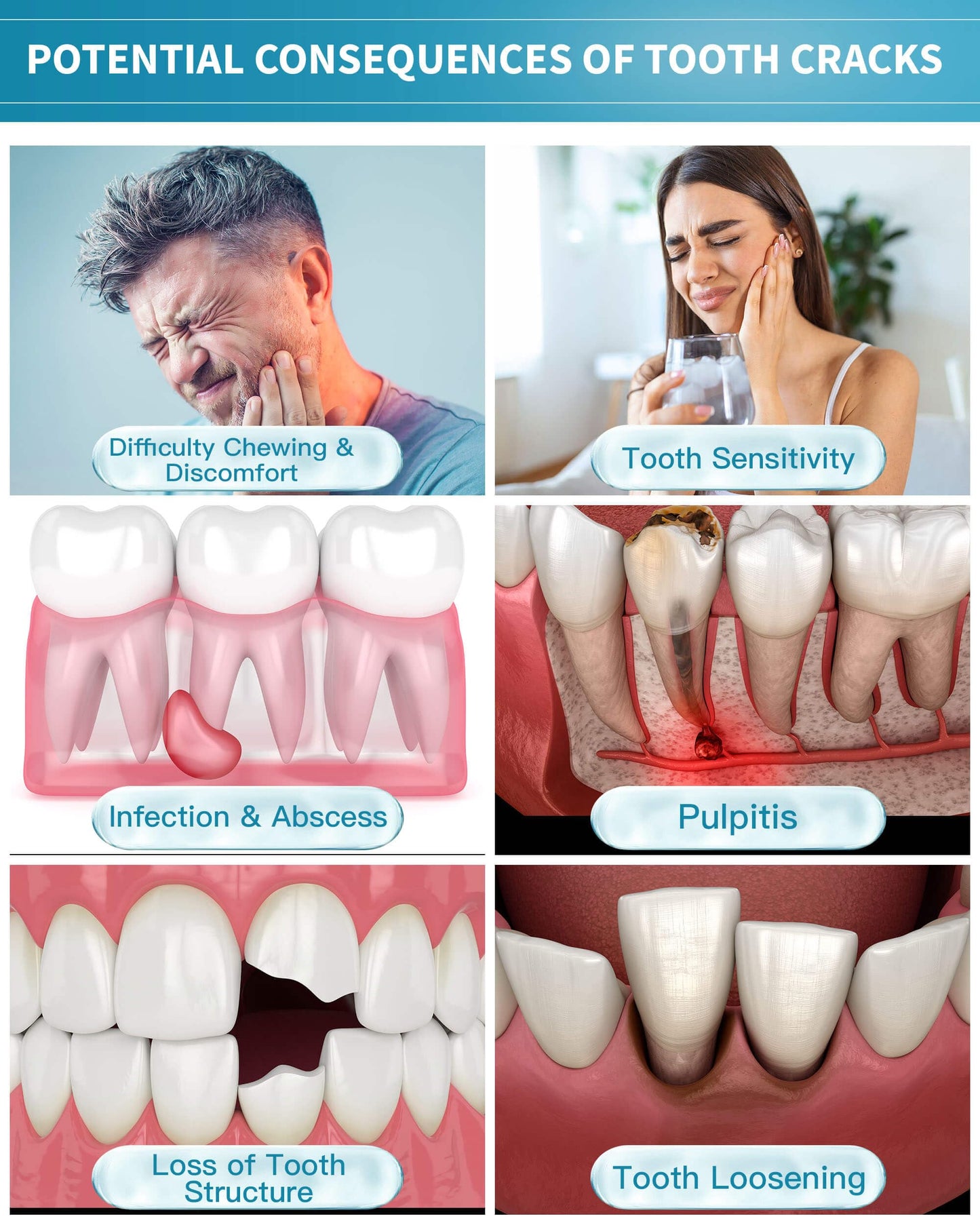Healing Teeth Crack Toothpaste - Enamel Repair & Remineralizing 100g