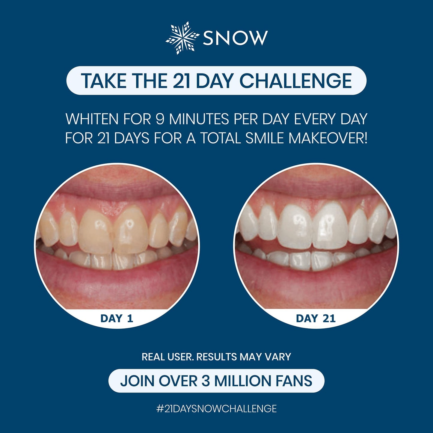 Snow Teeth Whitening Kit - LED Mouthpiece, Hydroxyapatite, 3 Wands
