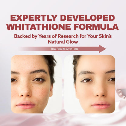 ILO Whitathione – Glutathione + White Tomato Antioxidant Powder with Vitamin C & E | 30-Pack Daily Glow Support