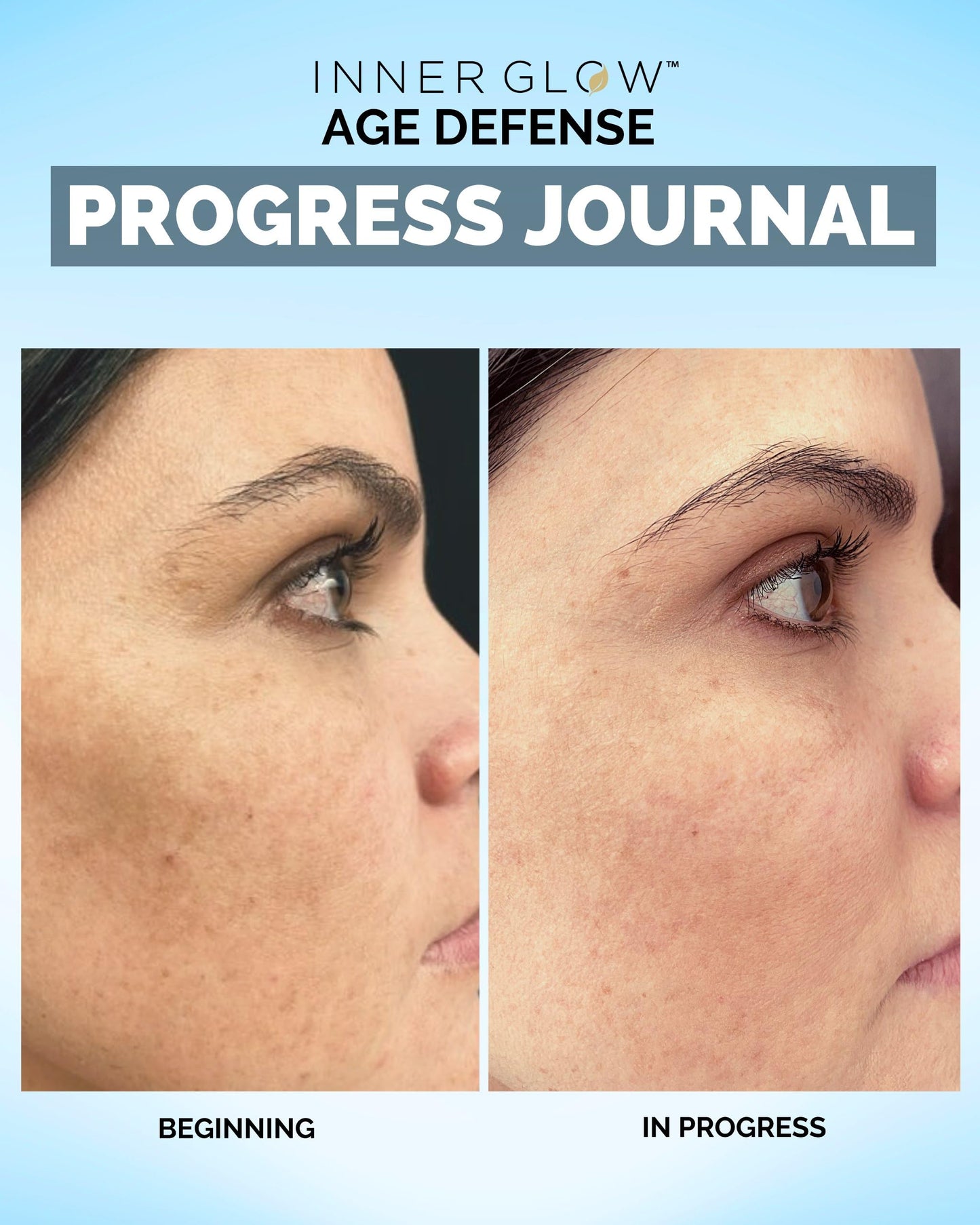 Inner Glow Age Defense Vitamins – Dermatologist & Plastic Surgeon Developed Antioxidant Formula for Photoaging and Melasma – Vegan, Gluten-Free – 60 Capsules
