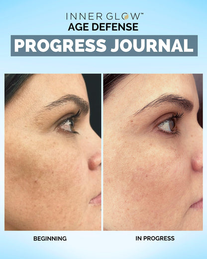 Inner Glow Age Defense Vitamins – Dermatologist & Plastic Surgeon Developed Antioxidant Formula for Photoaging and Melasma – Vegan, Gluten-Free – 60 Capsules