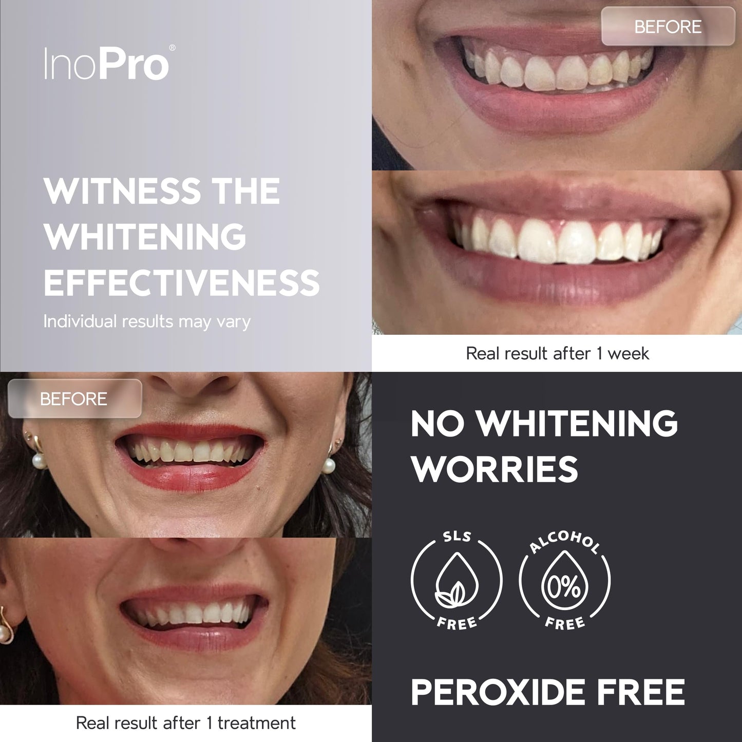 InoPro Natural Teeth Whitening Strips Kit – 21 Treatments (42 Strips) – Peroxide-Free, Sensitive Teeth Whitener with Papain & Bromelain