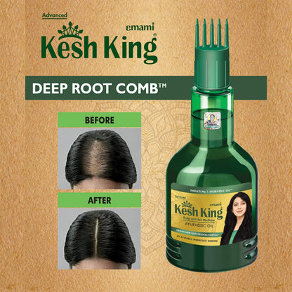 Kesh King Ayurvedic Hair Oil - 300ml | 21-Herb Formula for Hair Growth & Reduced Hairfall