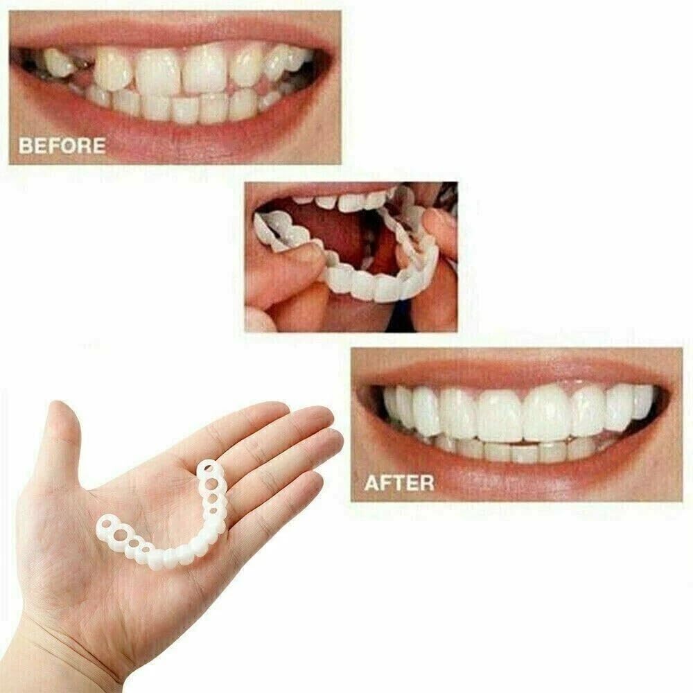 2 Pairs Natural-Looking Temporary Smile Solutions – Top & Bottom Adjustable, Comfortable Experience