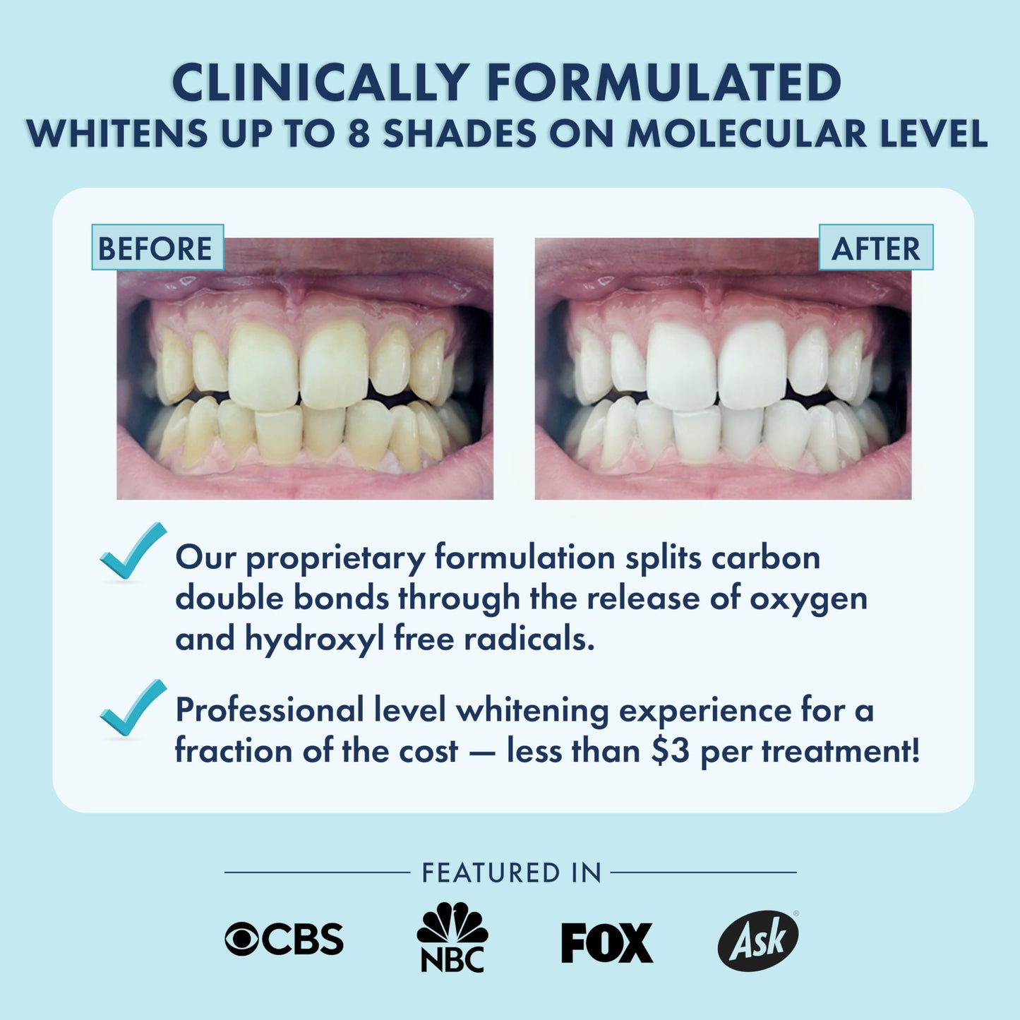 LIVFRESH Teeth Whitening Strips – 28 Strips, 14 Treatments | Enamel Safe