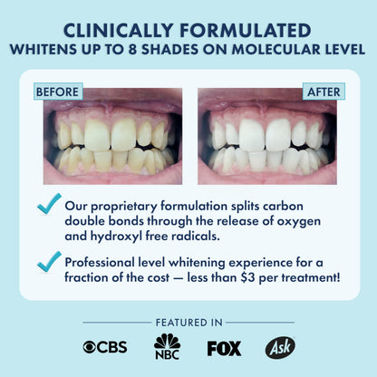 LIVFRESH Teeth Whitening Strips – 28 Strips, 14 Treatments | Enamel Safe