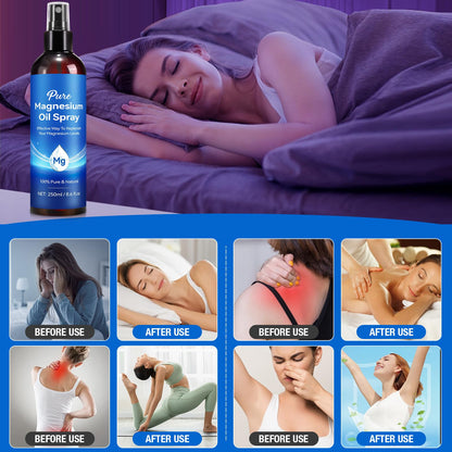 Magnesium Oil Spray 8.6 Fl Oz – Pure Topical Magnesium for Skin, Feet & Body