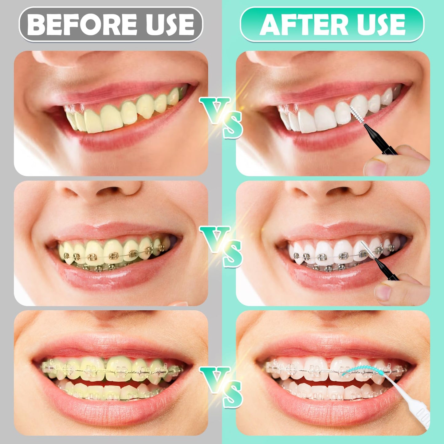 MAPVOLUT 200-Piece Interdental Brush Set for Braces - Travel-Friendly Oral Care