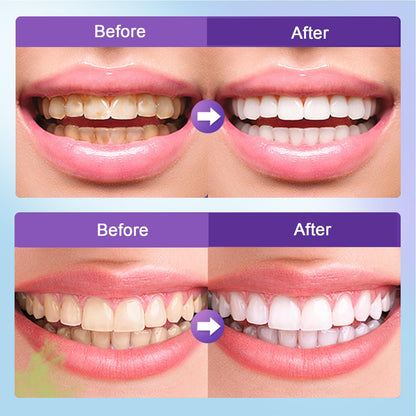 Microcrystalline Hydroxyapatite Powder | 50g Toothpaste for Stain Removal & Fresh Breath
