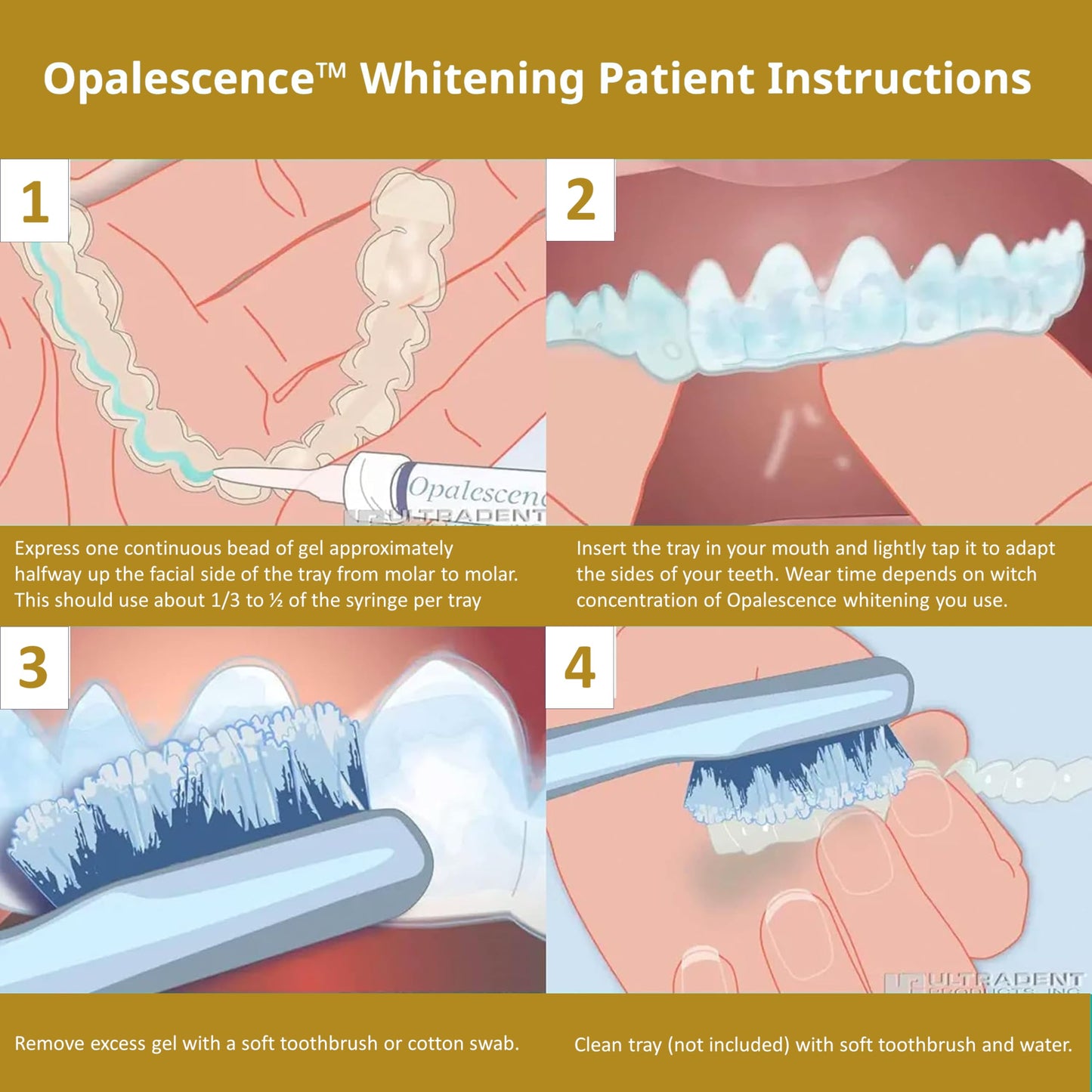 Opalescence 45% Whitening Gel – 4 Syringes Refill (Mint) | Ultradent PF