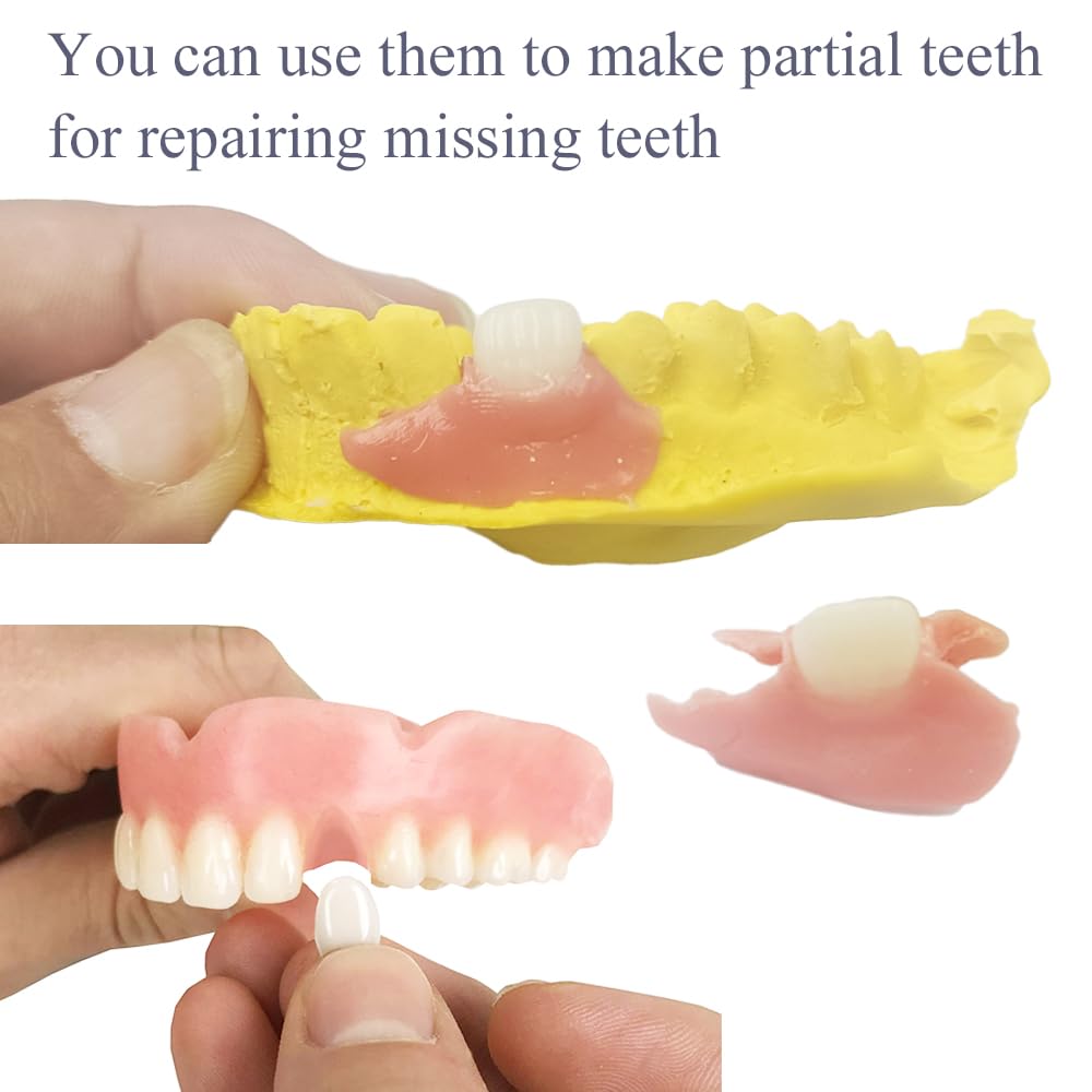 Missing Teeth Repair Kit - DIY Denture Parts at Home | Denture Material Kit