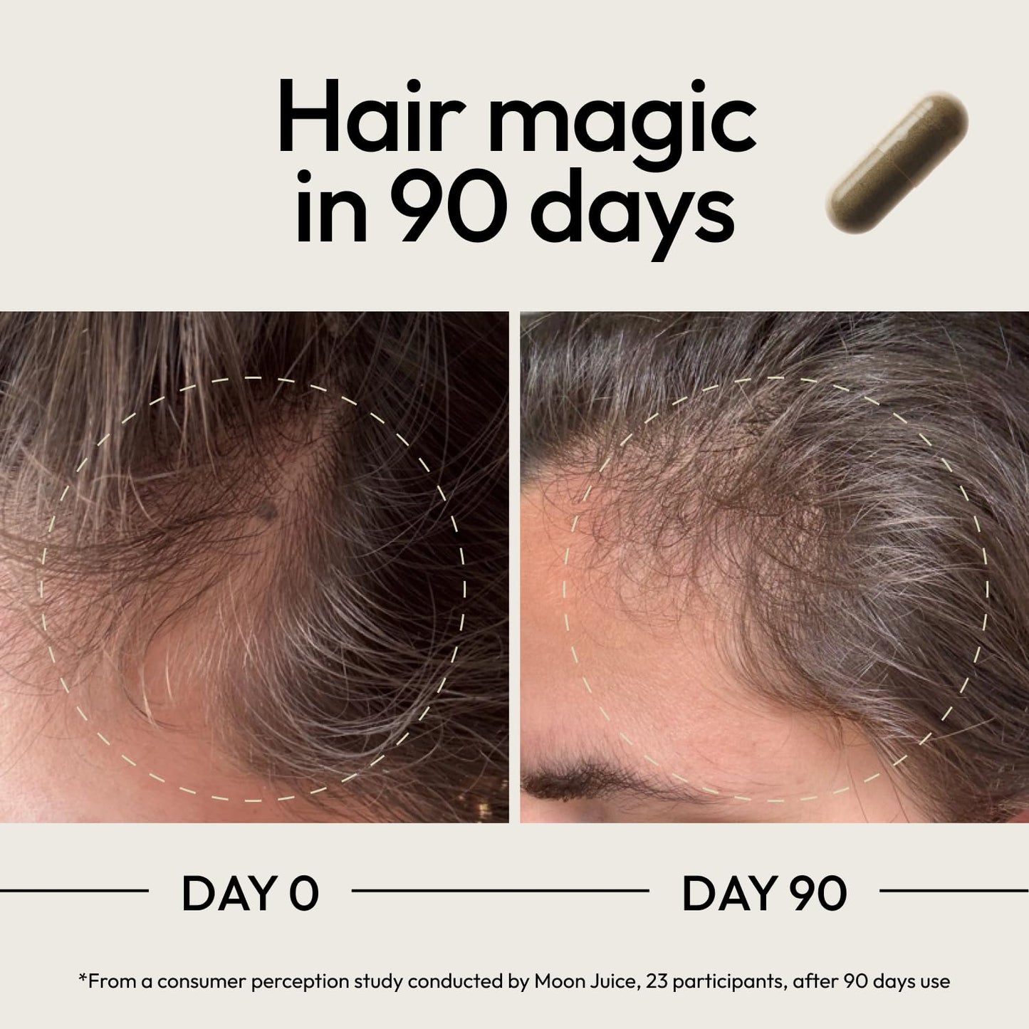Moon Juice SuperHair Hair Growth Vitamins for Women & Men | Thicker, Healthier Hair