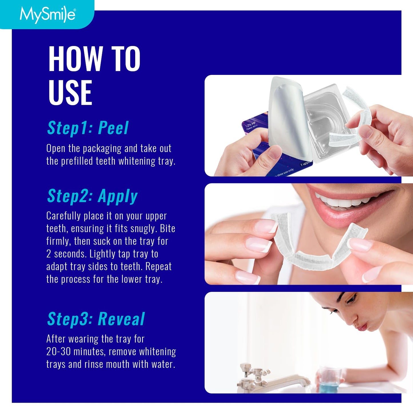 MySmile 7-Day Prefilled Teeth Whitening Trays Kit – 12% Hydrogen Peroxide, Mint