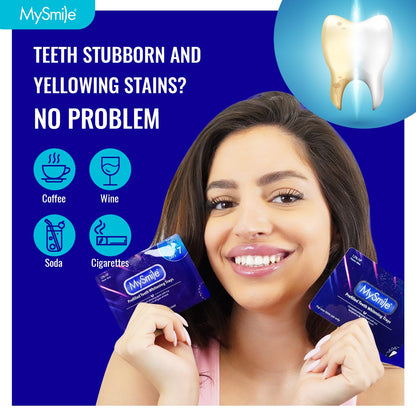 MySmile 7-Day Prefilled Teeth Whitening Trays Kit – 12% Hydrogen Peroxide, Mint