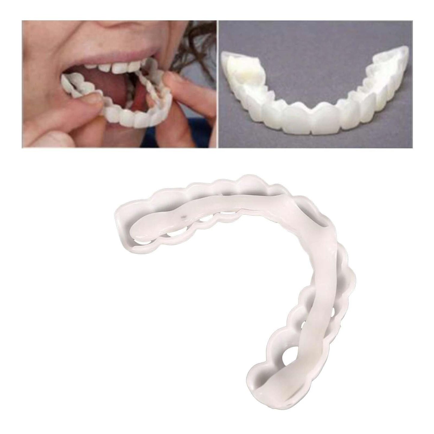 2 Pairs Temporary Adjustable Smile for Women and Men - White