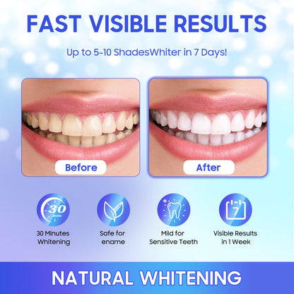 LUANERL Teeth Whitening Strips - 56 Strips (28 Treatments), Peroxide-Free, Enamel-Safe & Sensitivity-Free