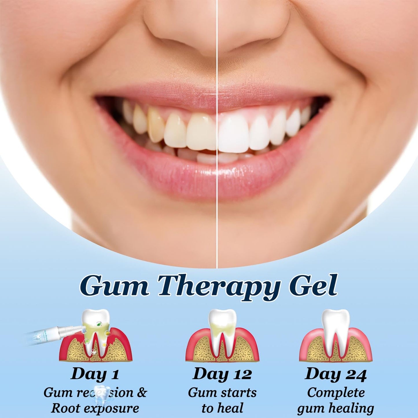 Neslemy Gum Gel & Therapy-Gel | Teeth Whitening & Gum Care (3PCS)
