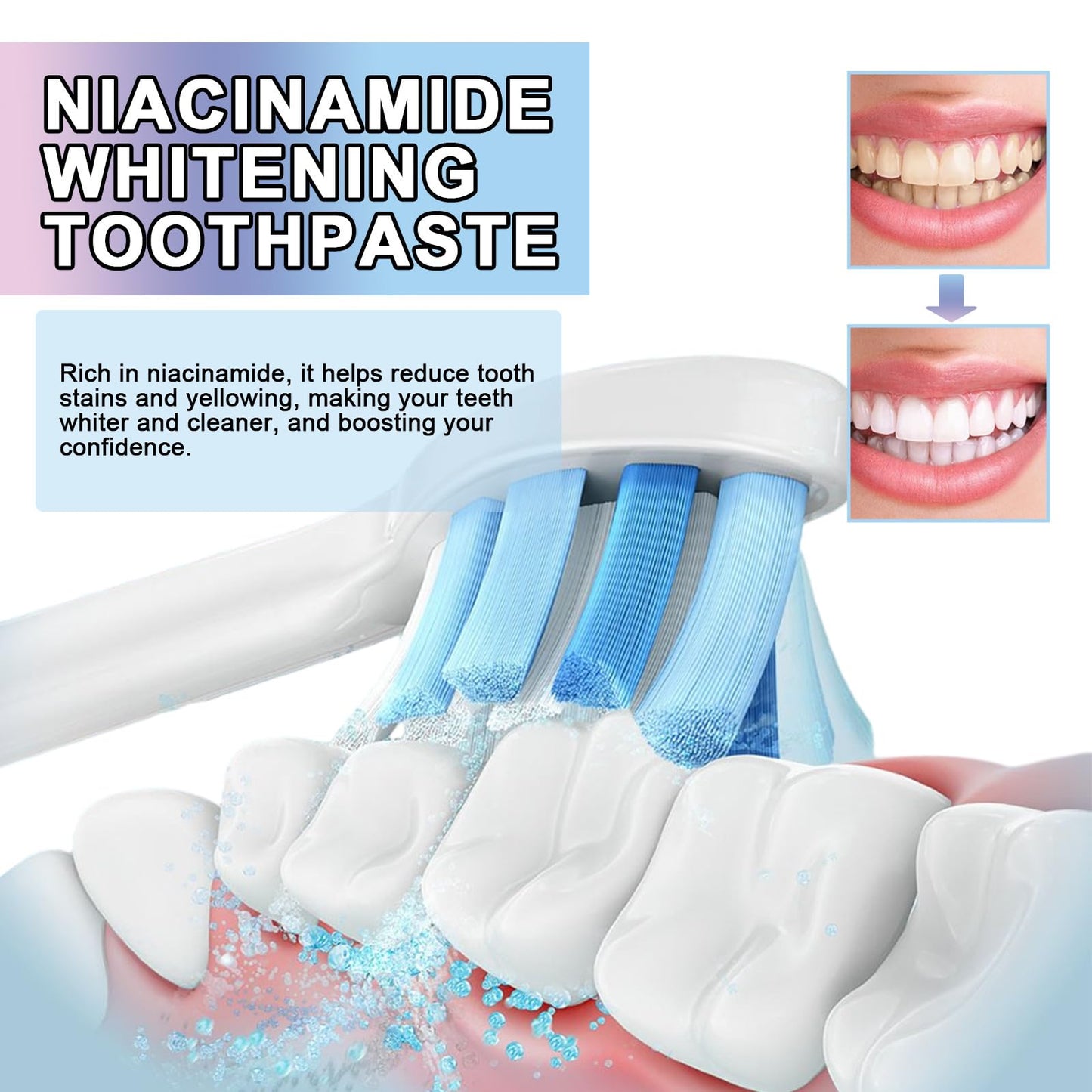 Niacinamide Whitening Toothpaste – 2Pcs (100g) | Fresh Breath & Stain Removal