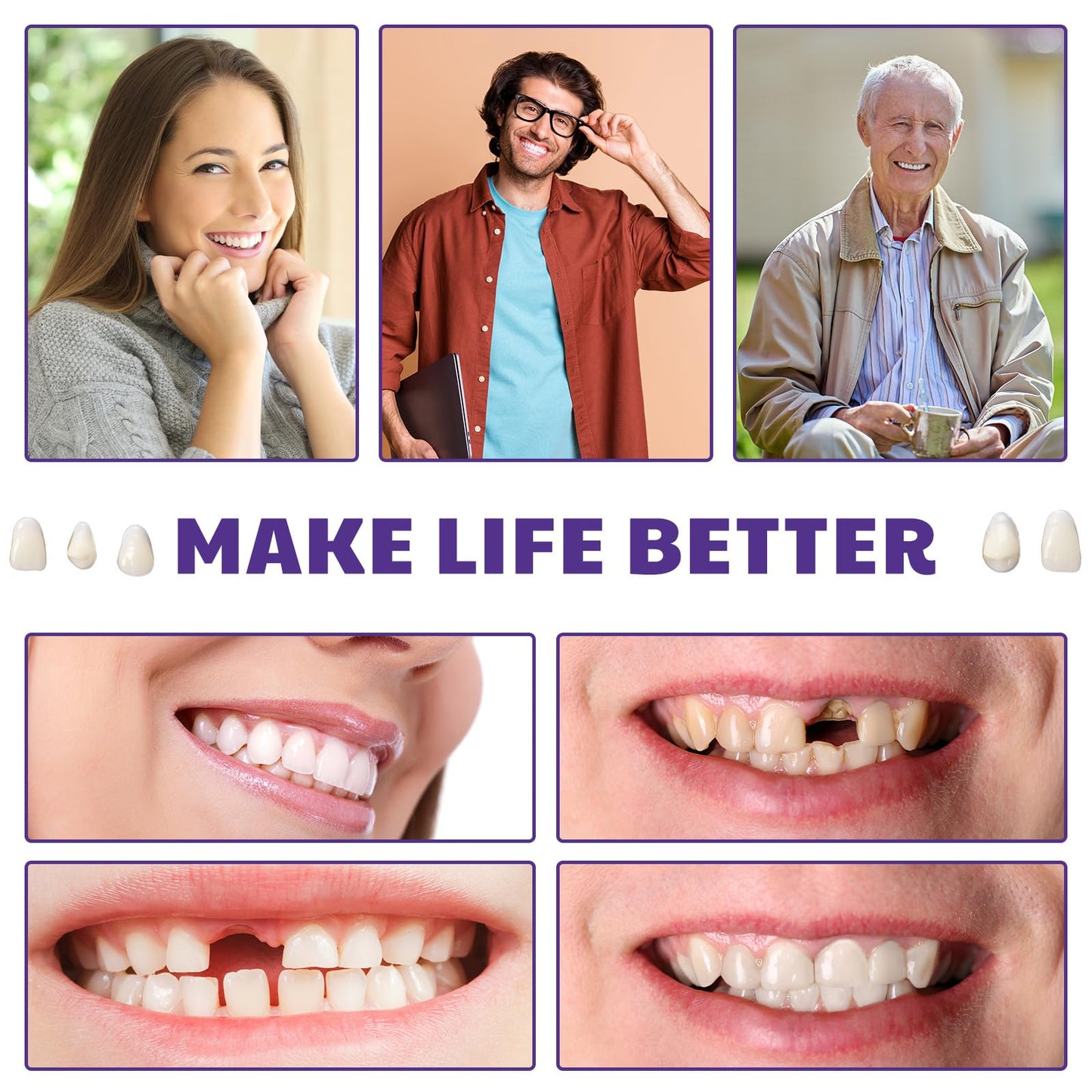 Nuanchu DIY Dentures Kit - 56 Synthetic Resin Teeth, Tweezers & Storage Boxes