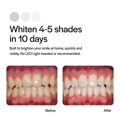 Opalescence Go 15% Mint Teeth Whitening Trays – 10 Treatments | Ultradent