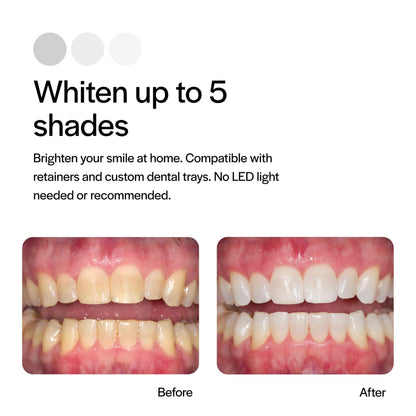 Opalescence 10% Teeth Whitening Kit - 8 Syringes Refills - Low Sensitivity - Made in USA | Ultradent 5211-4
