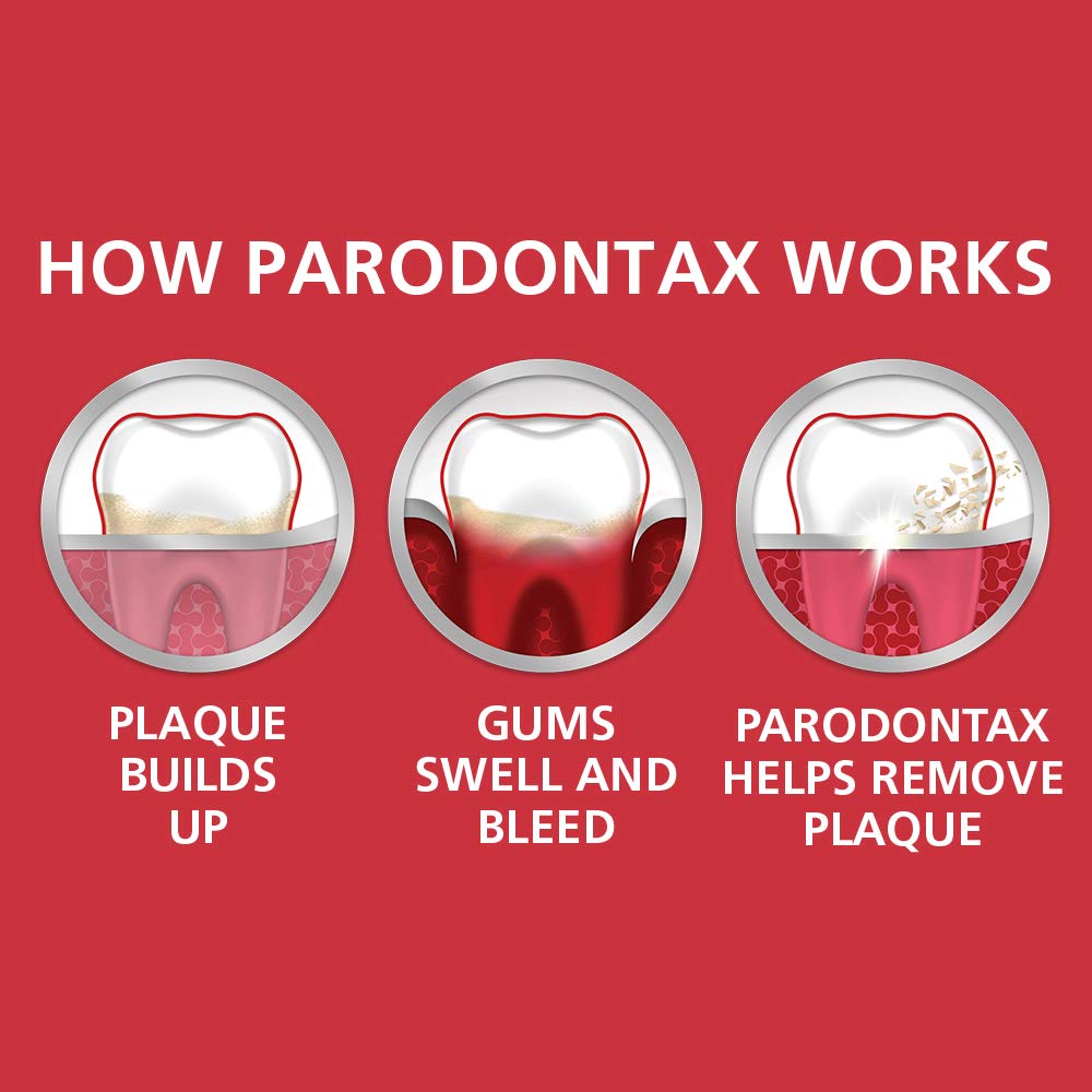 Parodontax Whitening Toothpaste for Bleeding Gums – Teeth Whitening & Gingivitis Treatment (3.4 oz)