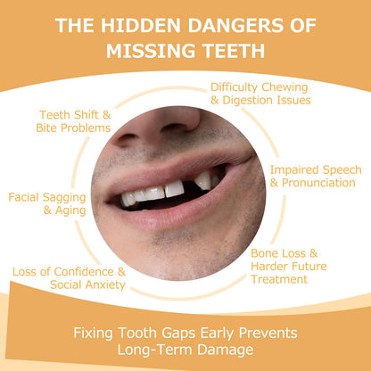 Partial Dentures for Missing Teeth & Gaps — Lightweight, Unbreakable Replacement Teeth (1 Tooth)