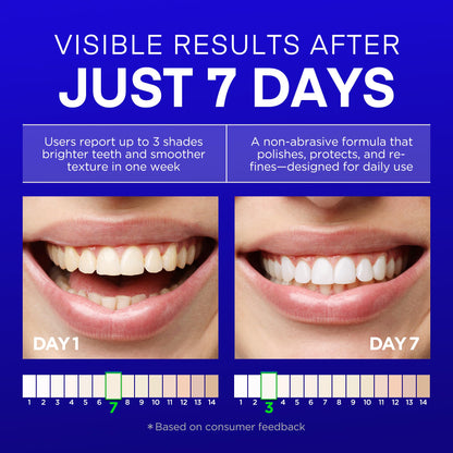 PearlSmile Hydroxyapatite Niacinamide Whitening Toothpaste – 10% nHAp, 5% Niacinamide, Fluoride-Free, 4.2oz (2-Pack)