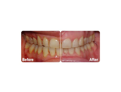 ProBiora Kids Oral-Care Probiotic Tablets for Kids | Healthy Teeth