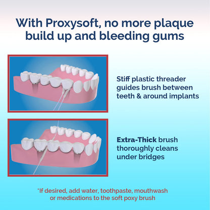 Proxysoft Dental Floss for Bridges & Implants – 2 Packs