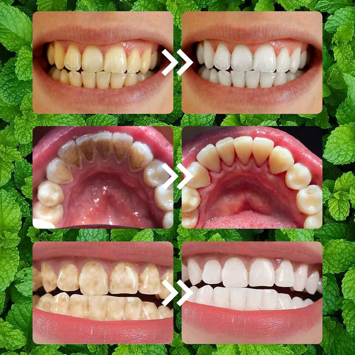 2PCS Purple Teeth Restoration Mineral Powder – Strengthen Teeth & Gums for Daily Use