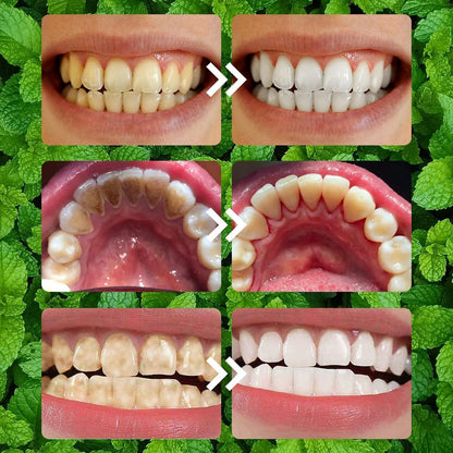 2PCS Purple Teeth Restoration Mineral Powder – Strengthen Teeth & Gums for Daily Use
