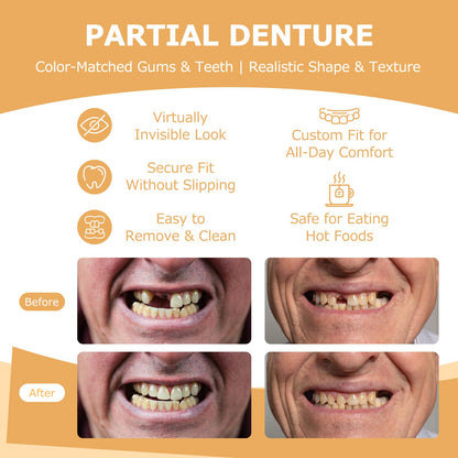 Partial Dentures (2 Teeth) – Lightweight, Durable Replacement Teeth for Missing Teeth