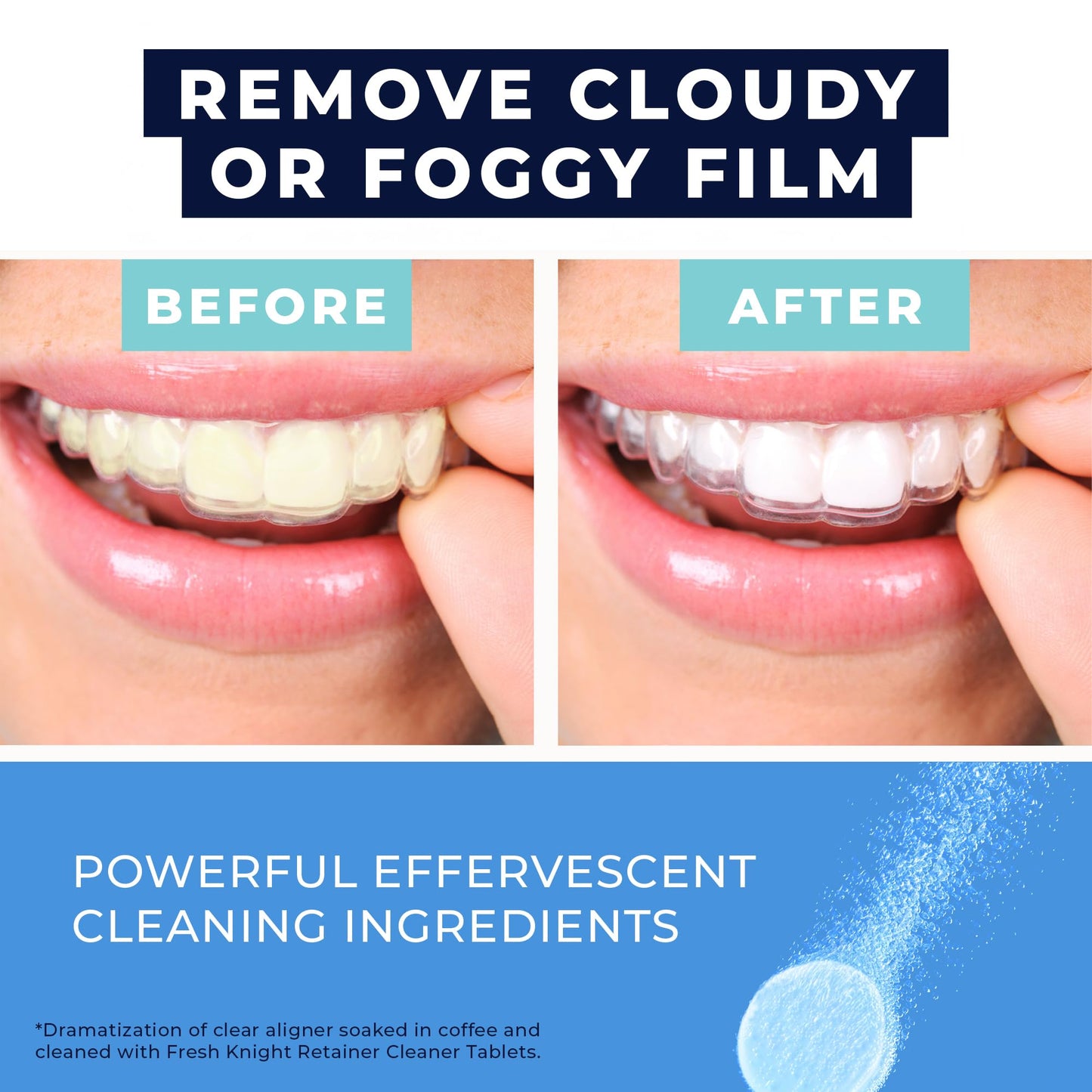 Retainer Cleaner Tablets 120 | Invisalign, Denture & Dental Appliance Cleaner - 4 Month Supply