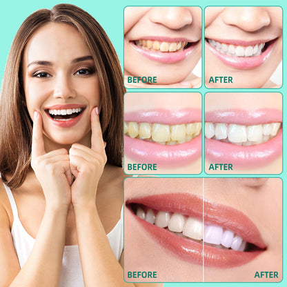 sefudun Whitening Coconut Pulling Oil (4.2 Fl Oz) – Teeth Whitening & Gum Health with Tongue Scraper